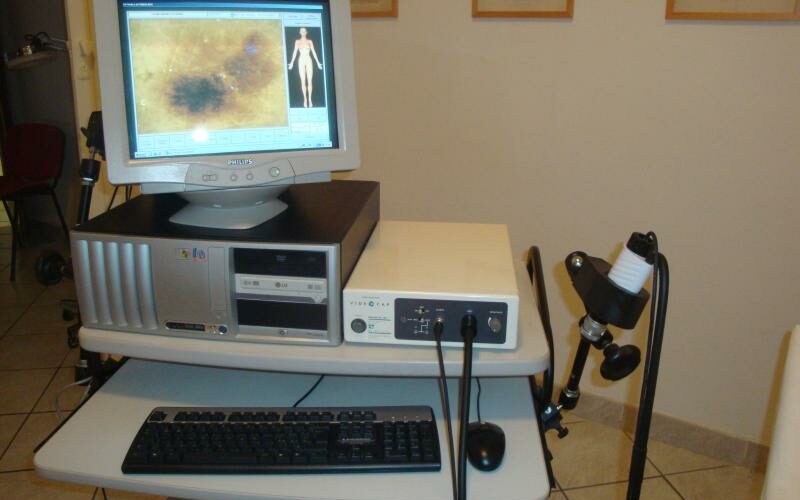 Siracusa, Asp8: Donazione dermatoscopio Airc e avvio programma gratuito prevenzione melanoma