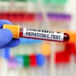 Nuova campagna screening HCV Sicilia nati dal 1969 al 1989