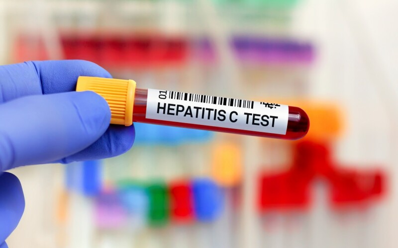 Nuova campagna screening HCV Sicilia nati dal 1969 al 1989