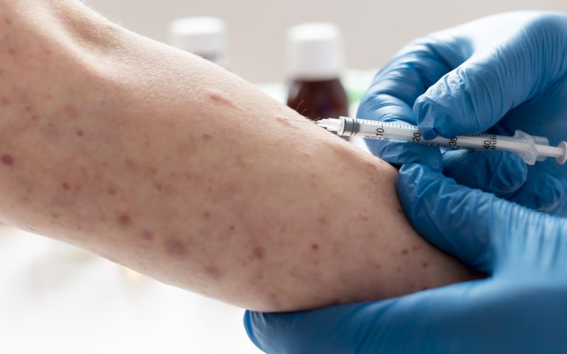 Aumento casi morbillo in Italia, alti anche in Sicilia